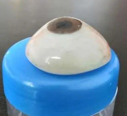 高分子義眼